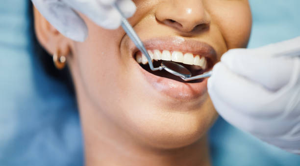 Best Emergency Treatment for Dental Infections or Abscesses in Cortland, NY